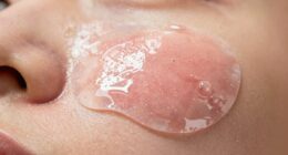 durable moisture resistant acne patches