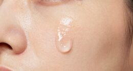 effective pimple patch adhesion