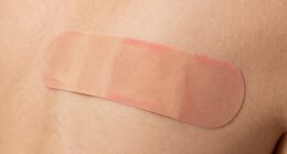 gentle patch application tips