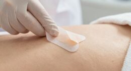 gentle patch removal technique