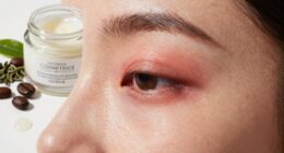 identify stinging ingredients quickly