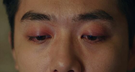 puffy eyes from screen