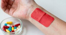 risky skin treatment combinations