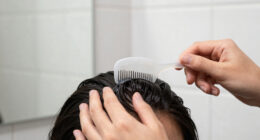 15 Best Best Scalp Serum Applicator Comb in 2026