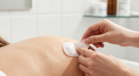 7 Best Hydrocolloid Acne Patches for Body Acne in 2026