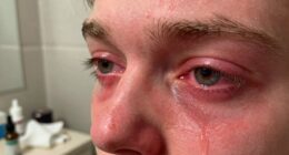 adjusting eye hygiene practices