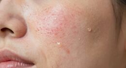 damaged skin cannot recover