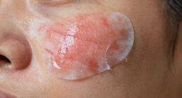 damaging skin by rushing