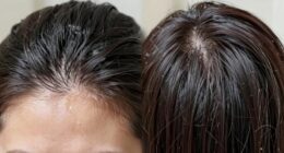 different care for scalp and ends