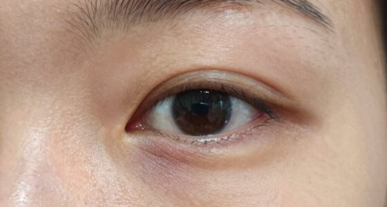 distinguishing eye puffiness