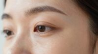 dry air causes eye puffiness