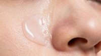 effective on whiteheads weak on bumps