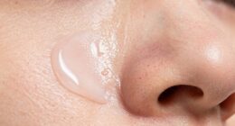 effective on whiteheads weak on bumps