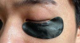 eye patch dryness causes