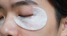 eye patch irritation after exfoliation