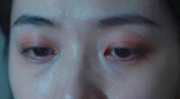 eye strain and dryness
