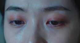 eye strain and dryness