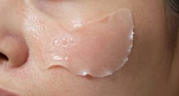 improper application causes peeling