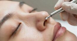 incorrect pressure causes marks