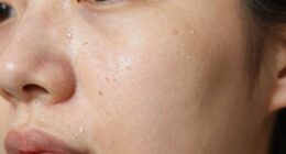 invisible patches instantly visible
