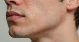 post shave skin irritation