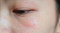 sensitive skin damage risks