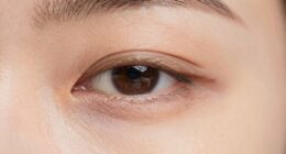 sensitive skin dehydration signs