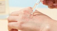 sensitive skin exfoliation risks