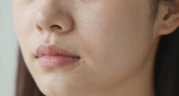 skin feels overly tight