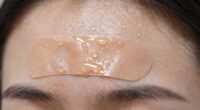 sweat impacts acne patch