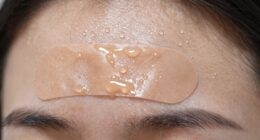 sweat impacts acne patch