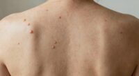 targeted treatment for body
