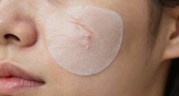 tightness on flexible skin