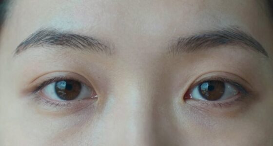 tiredness doesn t always cause dark circles