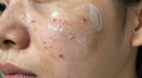 unclean skin reduces effectiveness
