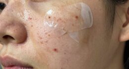 unclean skin reduces effectiveness